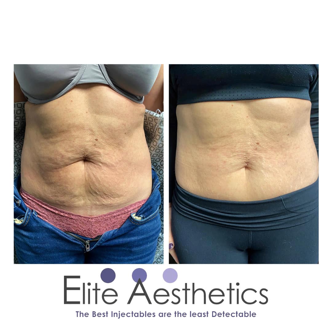 How do celebrities get their skin so shiny?